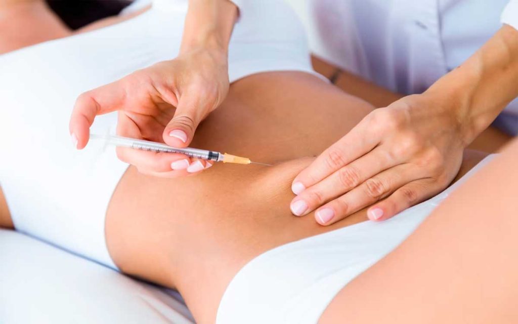 Descubre los grandes beneficios de la mesoterapia reductiva