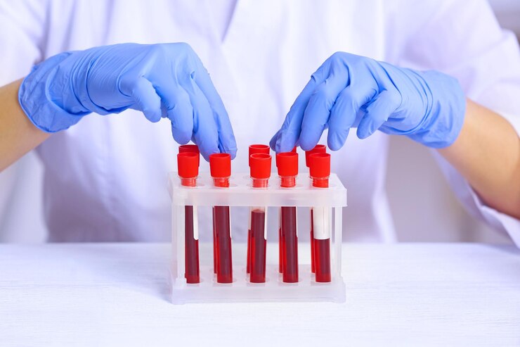 Química Sanguínea: Análisis y Valores Normales