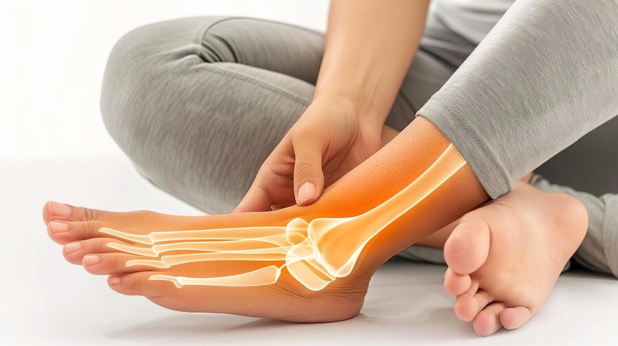 Fascitis Plantar: Causas, Síntomas y Tratamientos