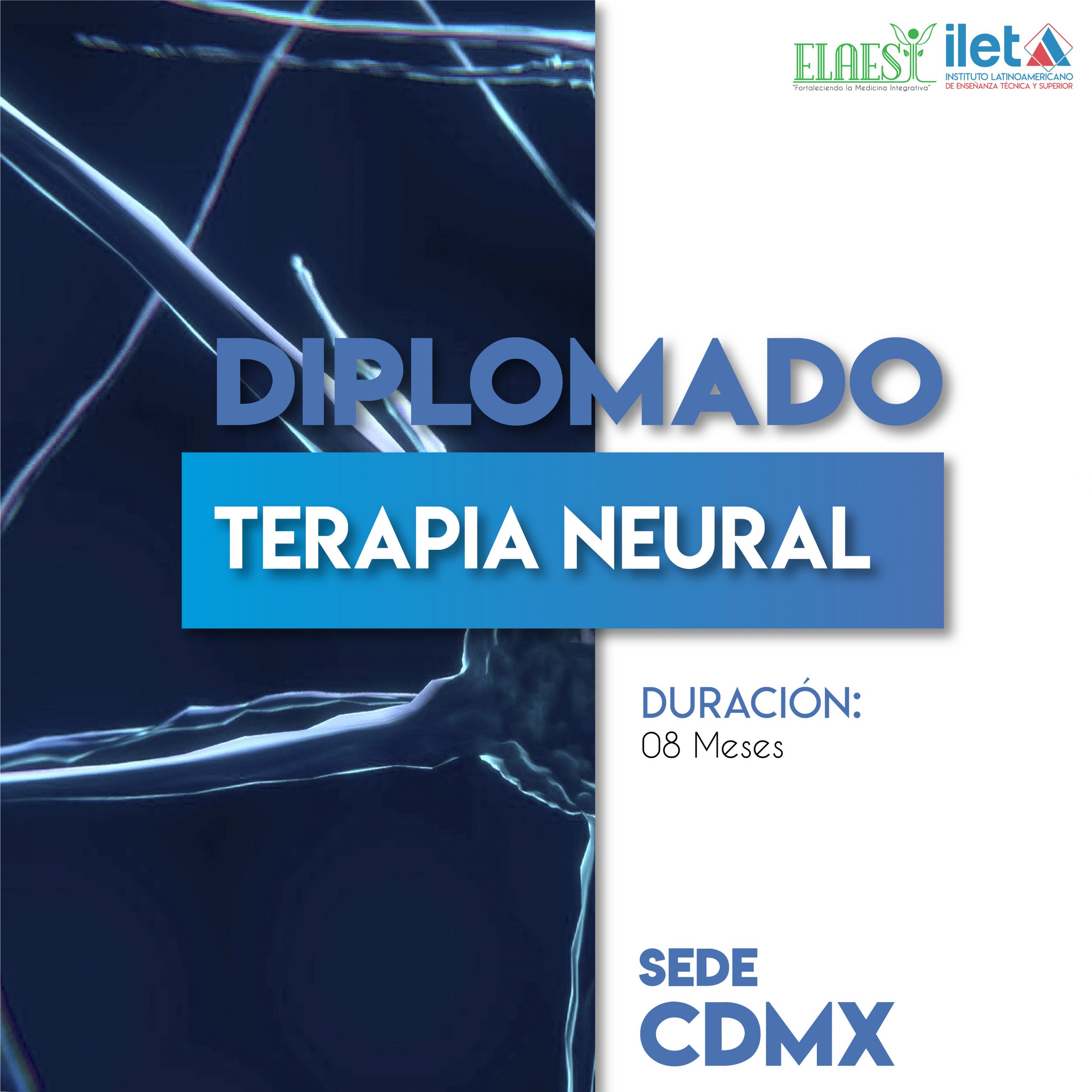 Terapia Neural Elaesi Elaesi